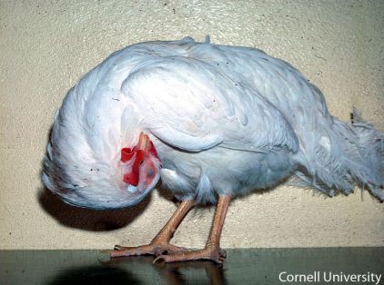 Torticolis